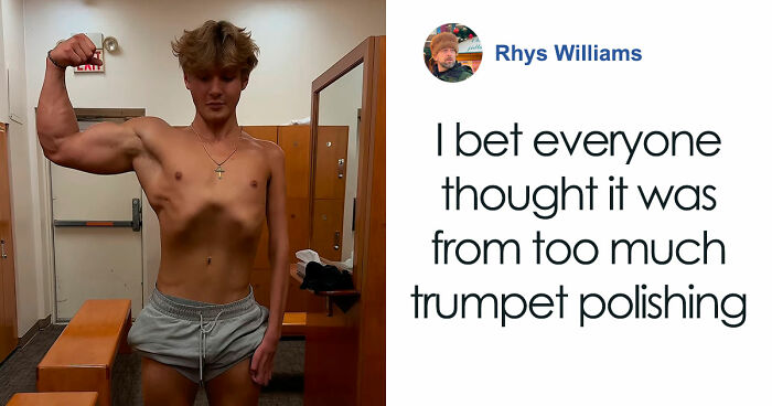 “I Gave Myself A Goal”: A 19-Year-Old Praised After Revealing Why Only One Of His Arms Is Jacked