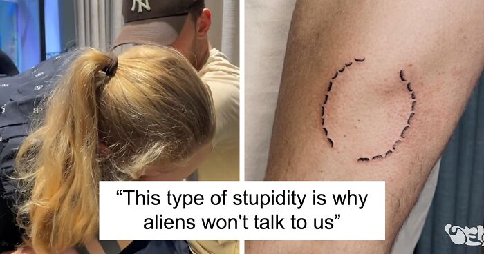 People Are Scared Man Will Get “Sepsis” After Getting His Girlfriend’s Bite Mark Tattooed