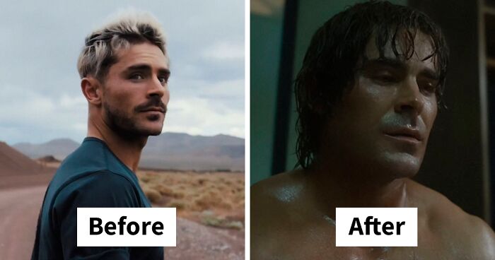 Zac Efron Surprises Fans With Physical Transformation Following Domestic Accident