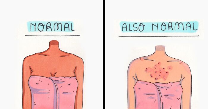 Artist Promotes Body Positivity And Mental Health In These 40 Relatable Comics (New Pics)