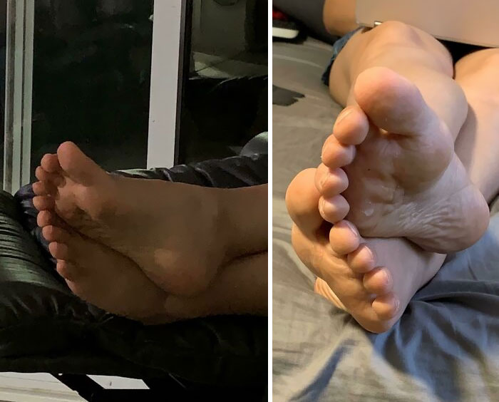 The Way My Fiancé’s Toes Line Up