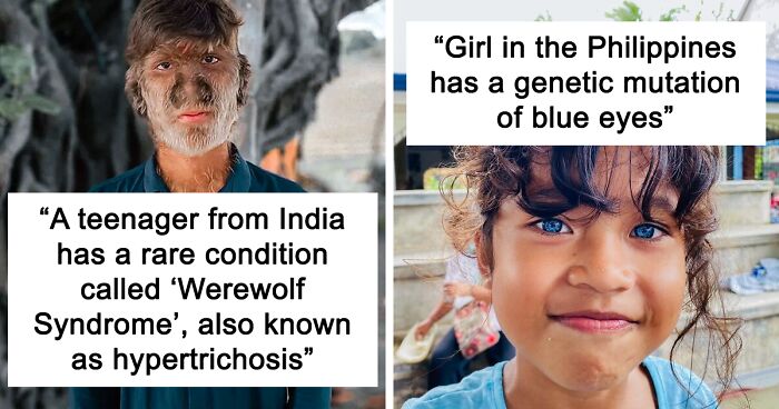 65 People Who Astounded Others With Their Bodily Quirks