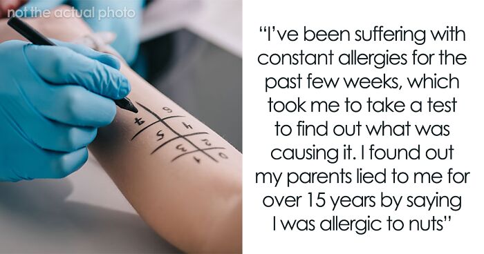 Woman Restricts Her Diet Because Of Nut Allergy, Finds Out It Was All A Lie By Her Mom