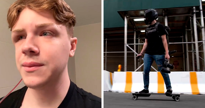 TikToker Left Waiting For New Skull After Skateboarding Injury He Can’t Remember