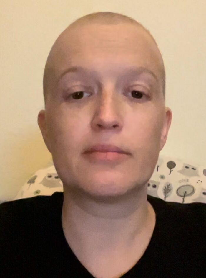 Hey Pandas  I Need Help And Support For My Cancer And Chemotherapy Journey - 42