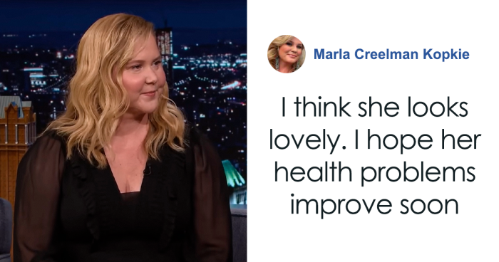 Amy Schumer Responds After Appearance On “The Tonight Show” Sparks Rumors About “Puffier” Face