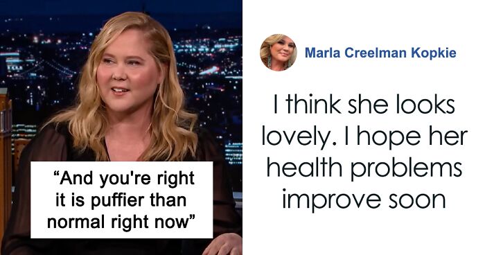 Amy Schumer Addresses Illness And Body Image After Criticism Over Her “Puffier” Face