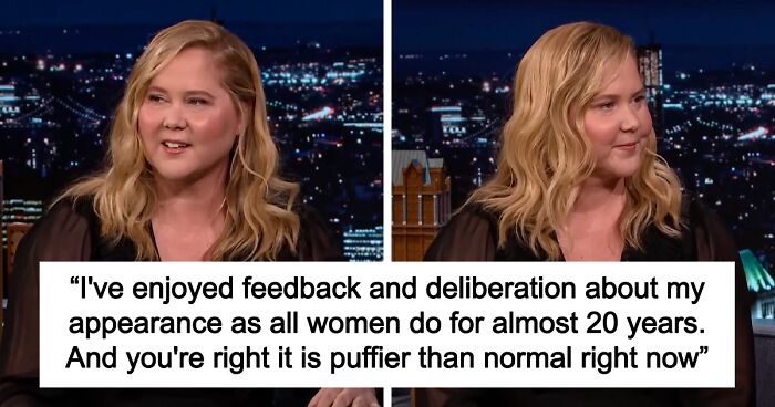 Amy Schumer Responds To Criticism About Her Face With Empowering Post