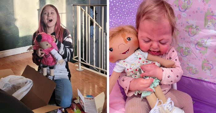 30 Comforting Look-Alike Dolls Created For Children With Rare Conditions By This Woman