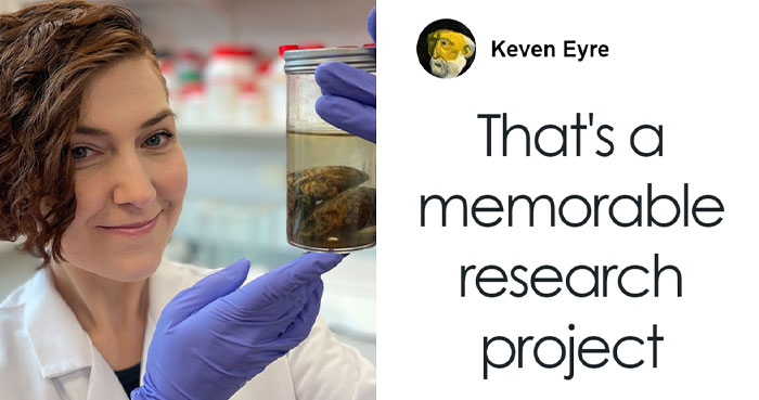 4,400 Preserved Human Brains Reveal Newly Discovered Biological Mechanism