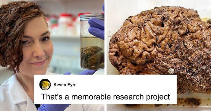 Thousands Of Brains Remain Preserved While Other Tissue Decays, Thanks To “Unknown Mechanism”