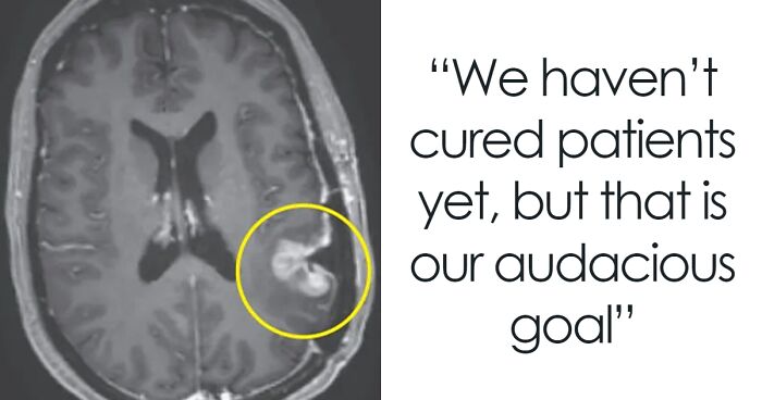 “None Of Us Could Believe It”: Scientists “Optimistic” After New Treatment Shrinks Brain Tumor