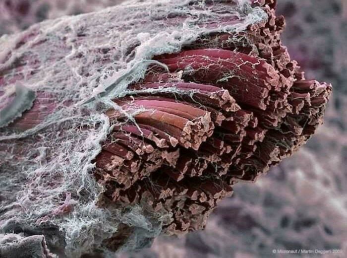 Muscle Tissue Through An Electron Microscope