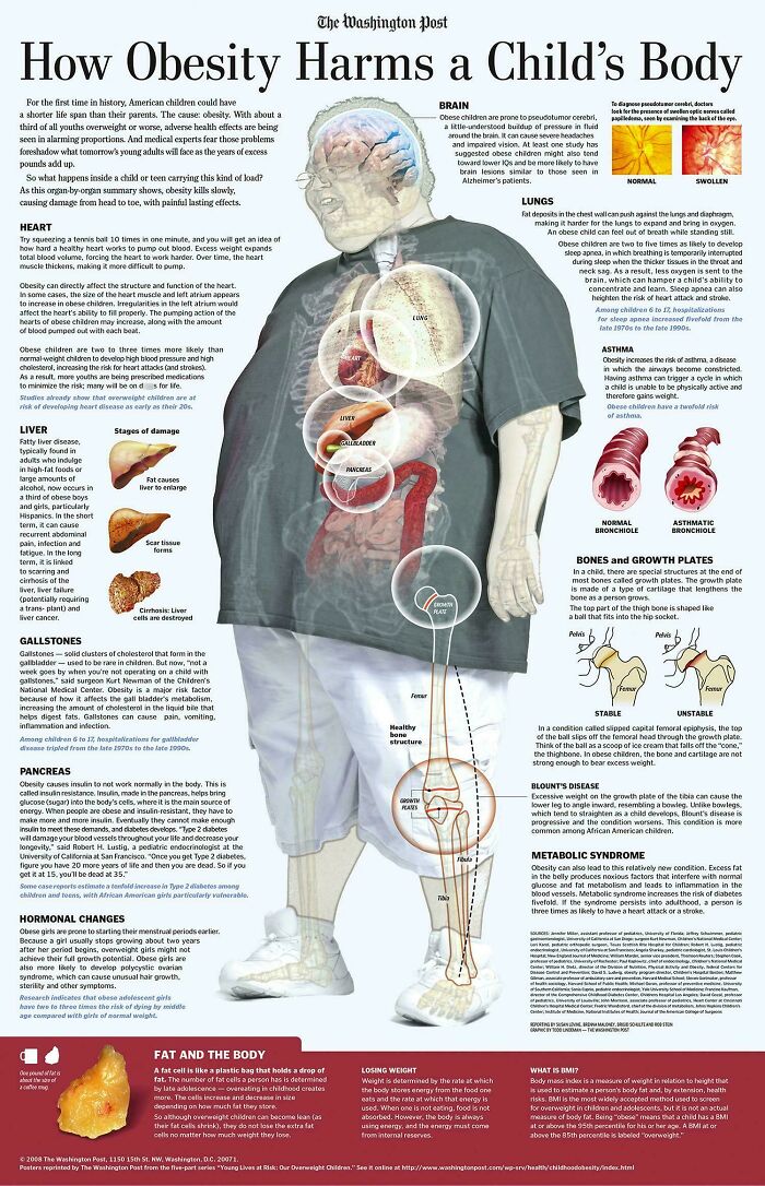 A Cool Guide On How Obesity Harms A Child's Body