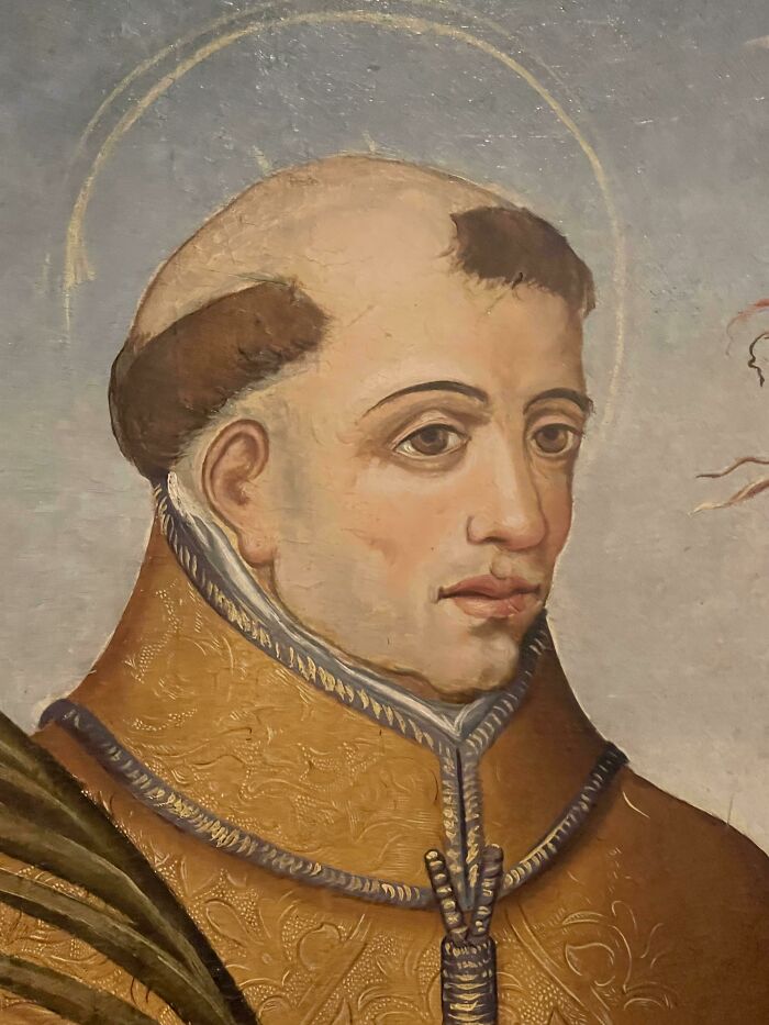 Painting of a man with an unusual hairstyle, featuring baldness with side patches, illustrating a tragic hair accident.