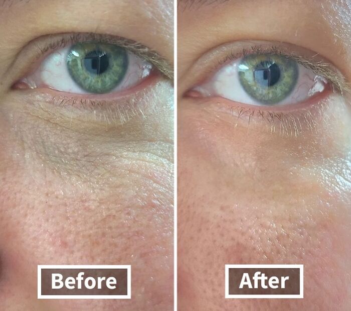 Say Goodbye To Dark Circles With Cerave Eye Repair Cream