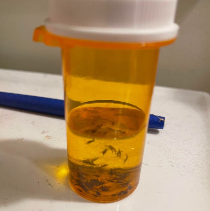 My Dad Keeps A Pill Bottle With 90% Alcohol In It To Fatally Poison Ticks (And Collect Them)