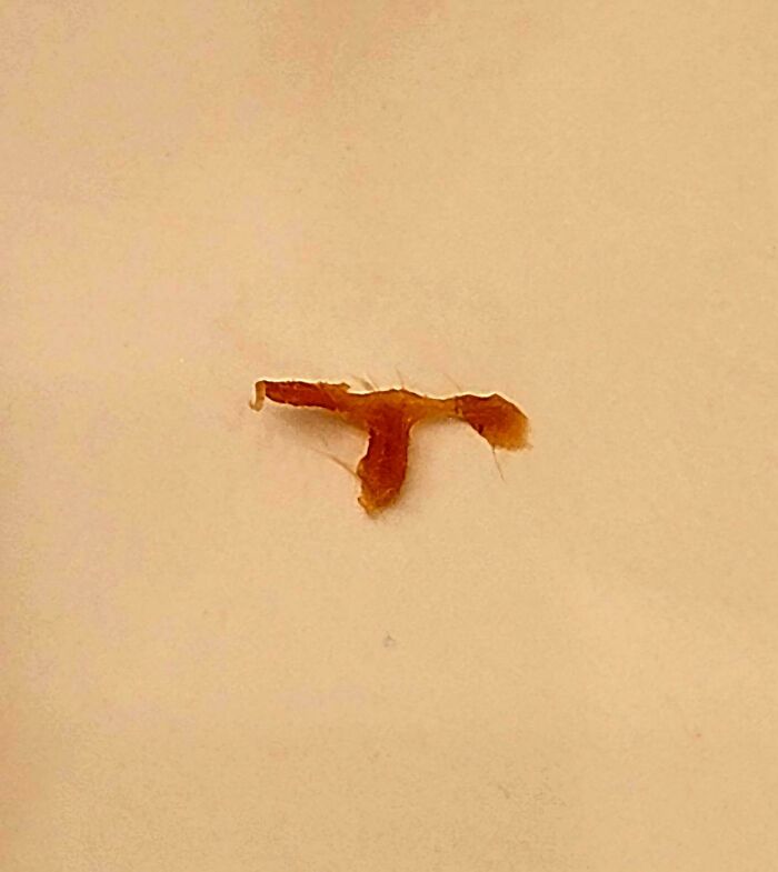 I (35f) Had Semi-Permanent Tubes Put In My Ears Last Summer. This Is My 4th Time Having Tubes, But My Third Set Was At 13. I Could Tell My Right Ear Was Getting Clogged, So I've Been Using Medicated Drops For A Few Days. Today, This Fell Out Of My Ear. It's In The Perfect Shape Of My Tube