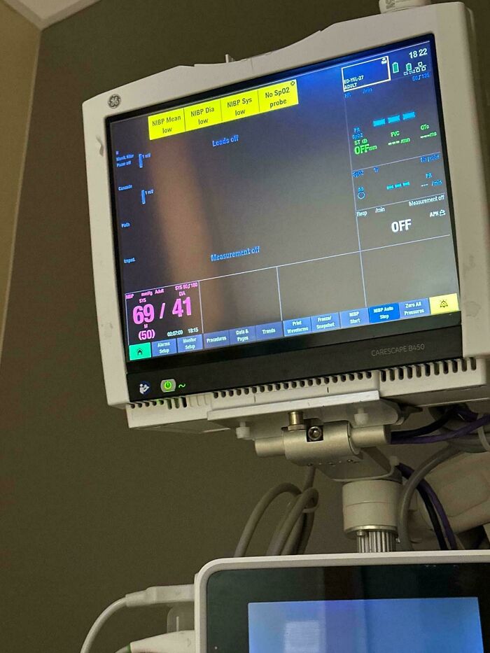 Medical monitor displaying low blood pressure readings, showcasing an interesting medical case.