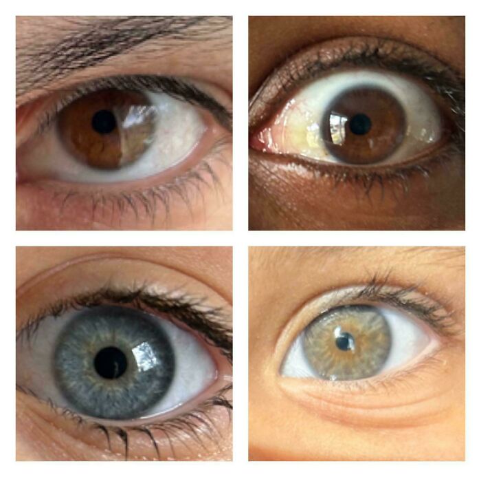 Family Eye Colors - Husband And I Have Brown Eyes And Somehow The Kids Came Out With Blue And Hazel-Ish Eyes!