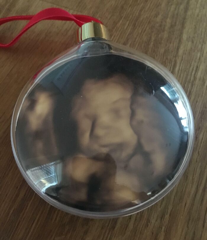 Brother-In-Law Got A Scan Of His Baby Put In A Bauble. It Looks Like They’ve Been Imprisoned In The Phantom Zone