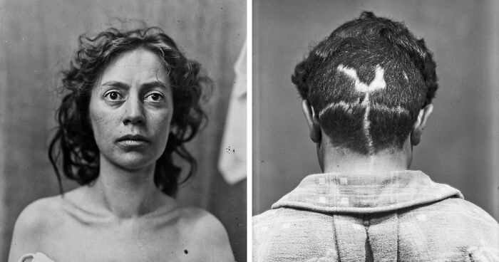 Portraits From The 20th Century That Bear Testimony To The Very Beginning Of Brain Surgery