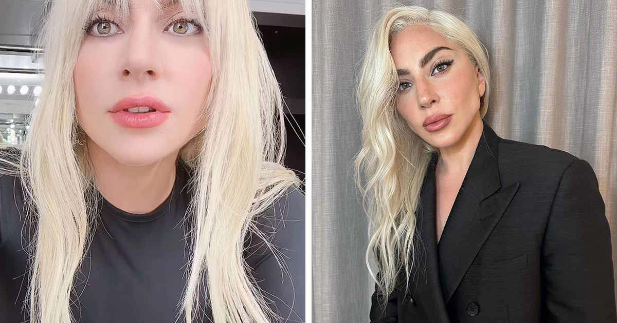 “WHERE ARE YOUR ETHICS?”: Lady Gaga Slammed For Promoting Migraine Med ...