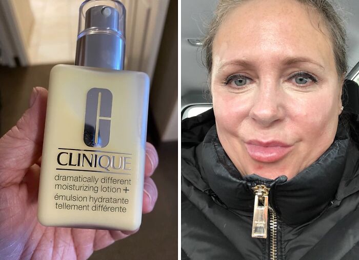 This Clinique Moisturizing Lotion Is A Classic And Amazon Agrees That It Remains A Hot Find