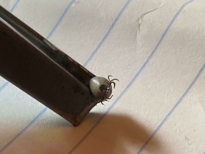 Had To Use Tweezers To Yank This Guy Out Of My Belly Button. I Live In Central New Jersey