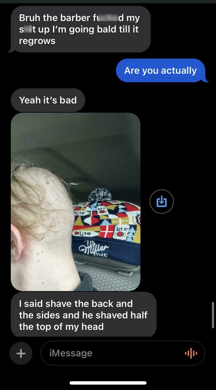 Hair accident text exchange showing a person with an unevenly shaved head.