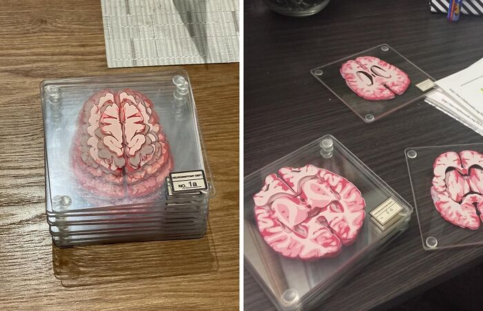  Anatomic Brain Specimen Coasters Will Leave You Scratching Your Head Instead Of The Table