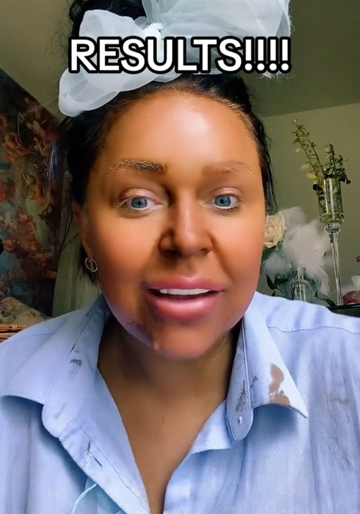 “Why On Earth Did You Use So Many?“: People Stunned After Woman’s Fake Tan Turns Green