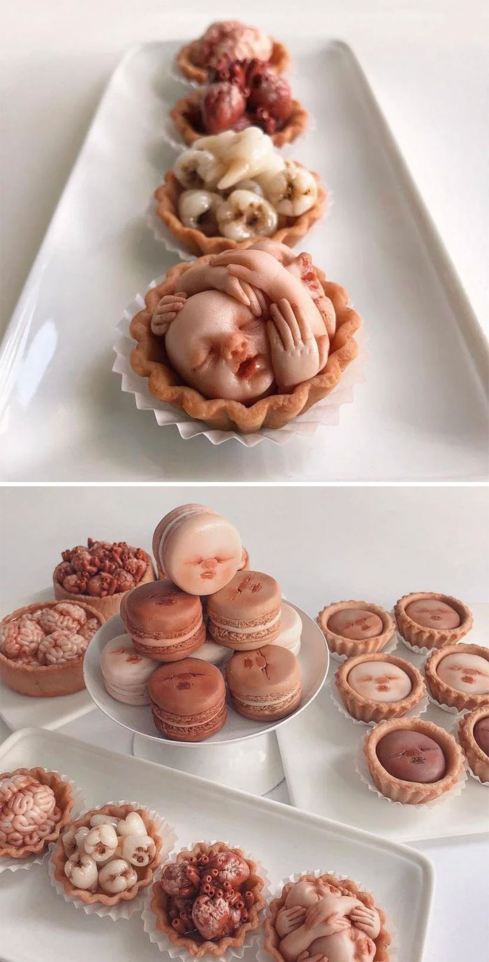 Anatomical Tartlets