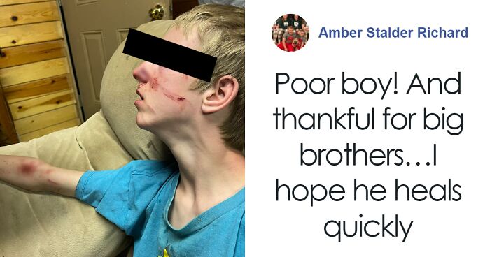 “That’s Why You Don’t Leave The Door Open”: Teen Boy Mauled By Bear While Watching TV