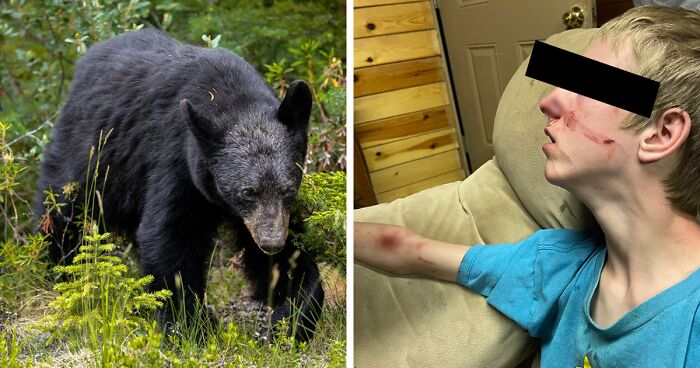 15-Year-Old Teen Boy With Rare Disorder Mauled By Black Bear In Arizona, Saved By Brother