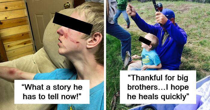 Brother Saves 15-Year-Old From Black Bear Mauling Him In Arizona: “We’re Feeling Blessed”