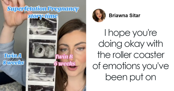 Mom Stunned To Join Handful Of Women Who Have Gotten Pregnant While Already Pregnant