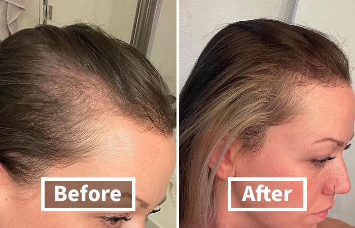 Users Swear That Viviscal Hair Growth Supplements Gave Them Visible Results