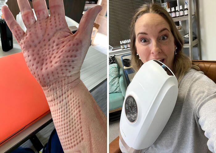 People With Trypophobia Might Not Agree With How Well This Cordless Electric Hand Massager Works