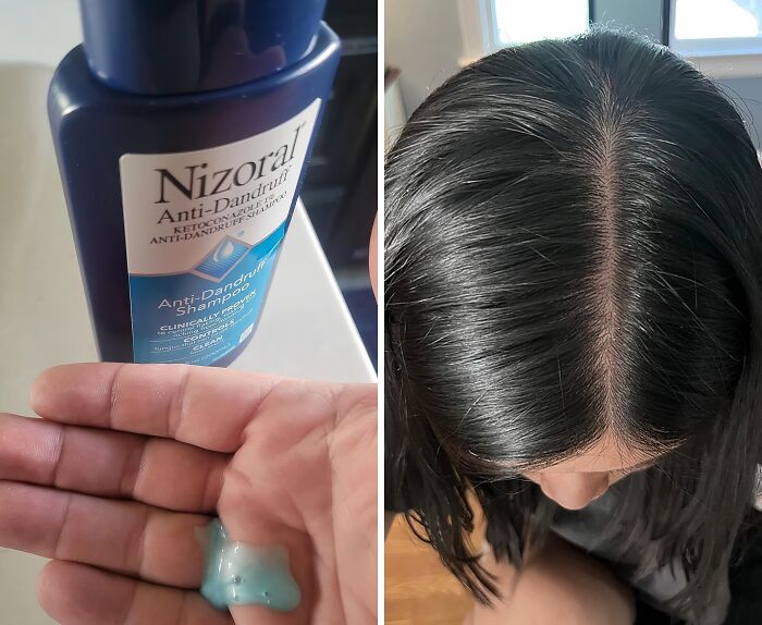  Nizoral Anti-Dandruff Shampoo: The Itch-Free, Flake-Free Solution Your Scalp Deserve