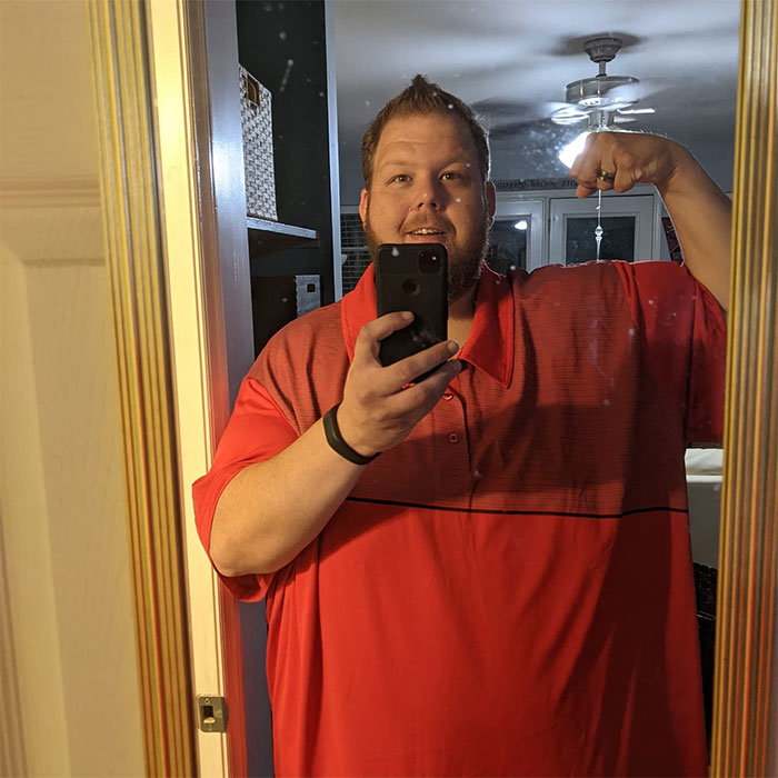 Man Raises $76k To Surgically Remove Excess Skin After Huge Weight-Loss Transformation