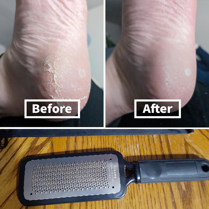 Heel Yeah! Smooth Feet Are Just A Few Strokes Away With The Foot File And Callus Remover