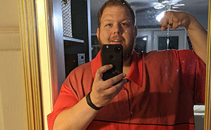 Man Raises $76k To Surgically Remove Excess Skin After Huge Weight-Loss Transformation