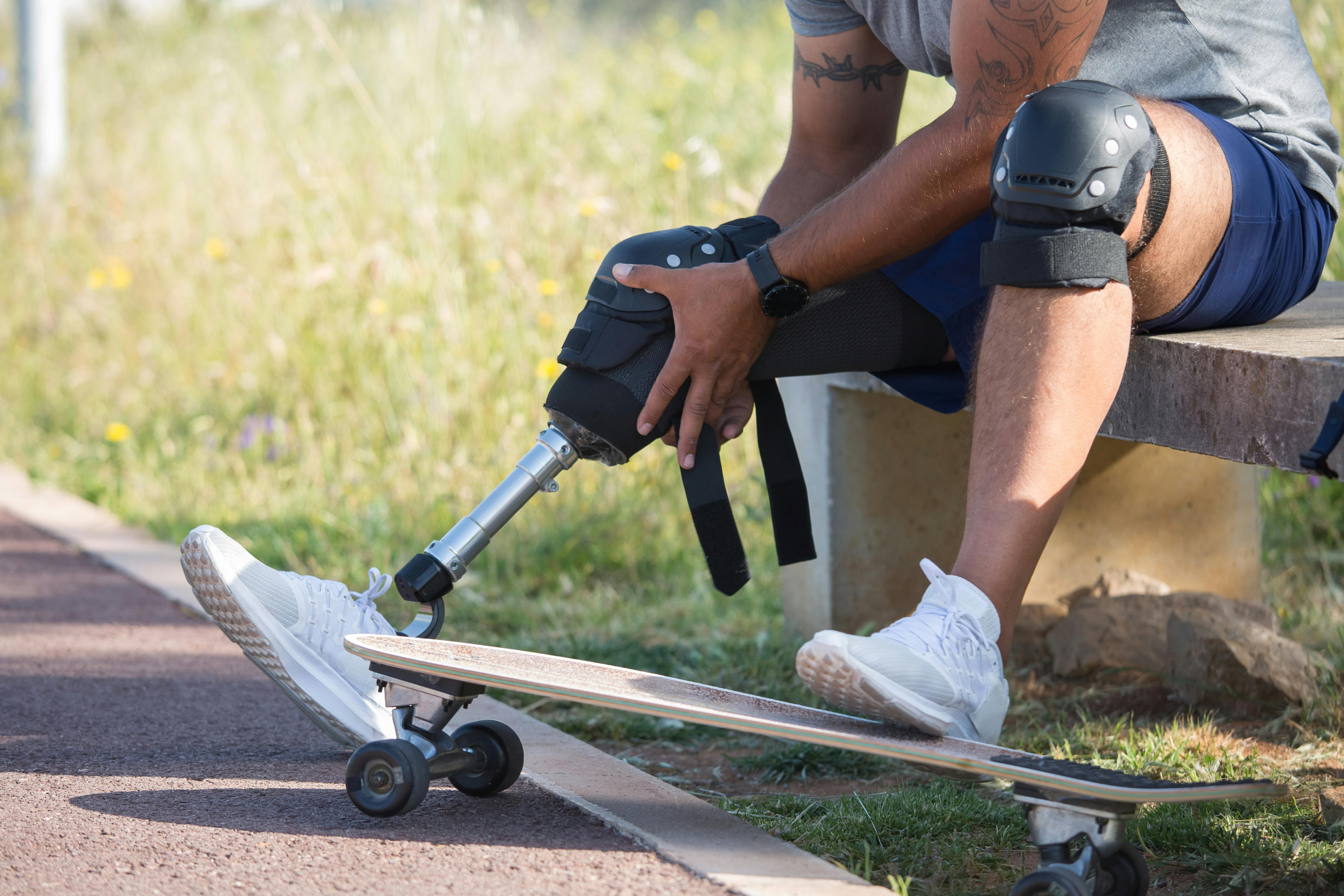 Guys' Trip Prompts Woman To Hide Her BF's $7000 Prosthetic, He Freaks Out When It Gets Ruined