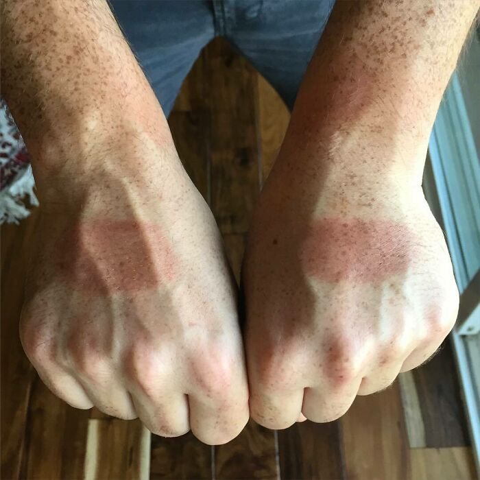 Bike Glove Fail During His 10-Hour Ride