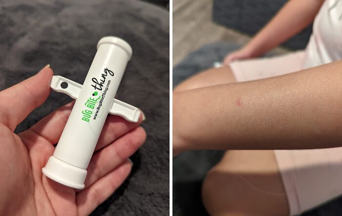 Find Relief From Itchy Bug Bites And Stings With The 