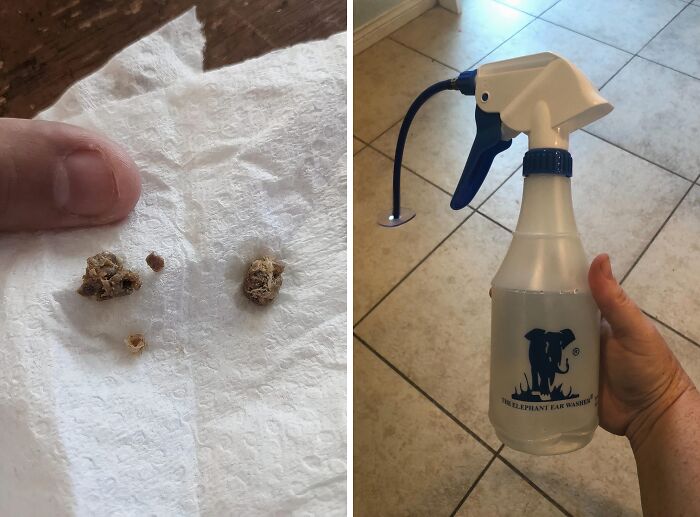  Ear Washer Bottle System: Ditch The Q-Tips And Blast Away Ear Wax Like A Pro!