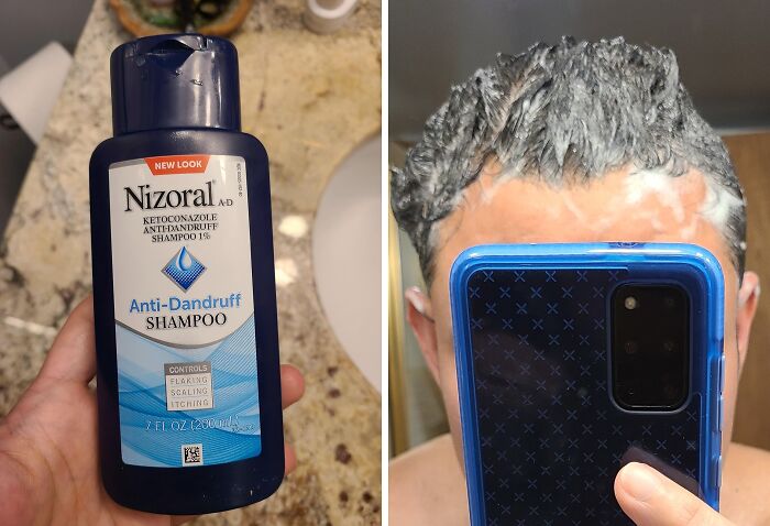 Experience The Difference Of A Dandruff Shampoo That Actually Works With Nizoral Anti-Dandruff Shampoo, The Dermatologist-Recommended Solution For Dandruff Control