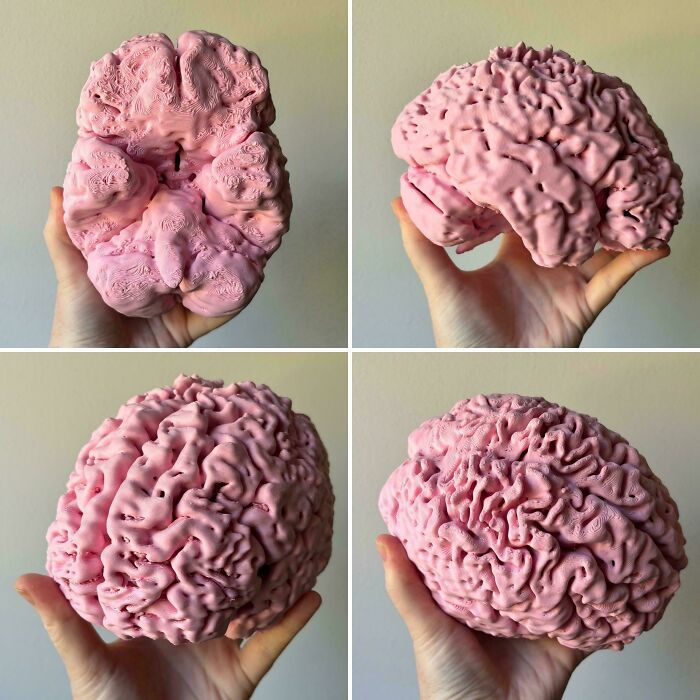 I Turned An Mri Of My Own Brain Into An Stl And Then Printed It At 1:1 Scale!