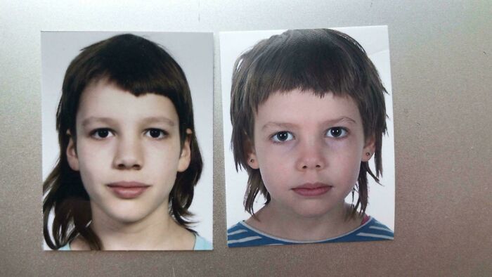 Two portrait photos of a young child with unusual haircut, illustrating tragic hair accidents.